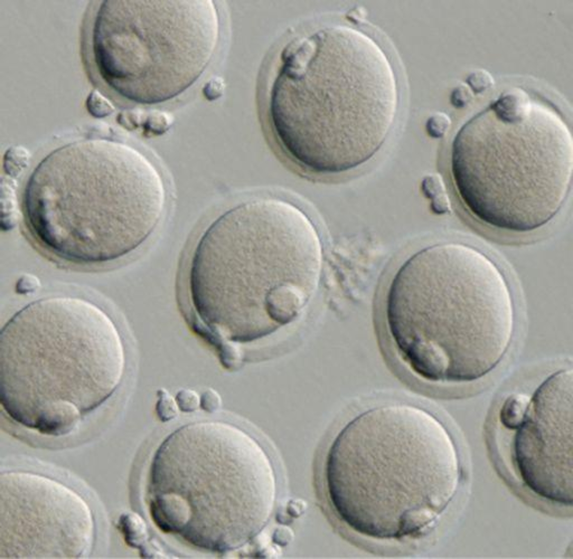 Troppa tv riduce fertilit&agrave;:20 ore settimana spermatozoi dimezzati