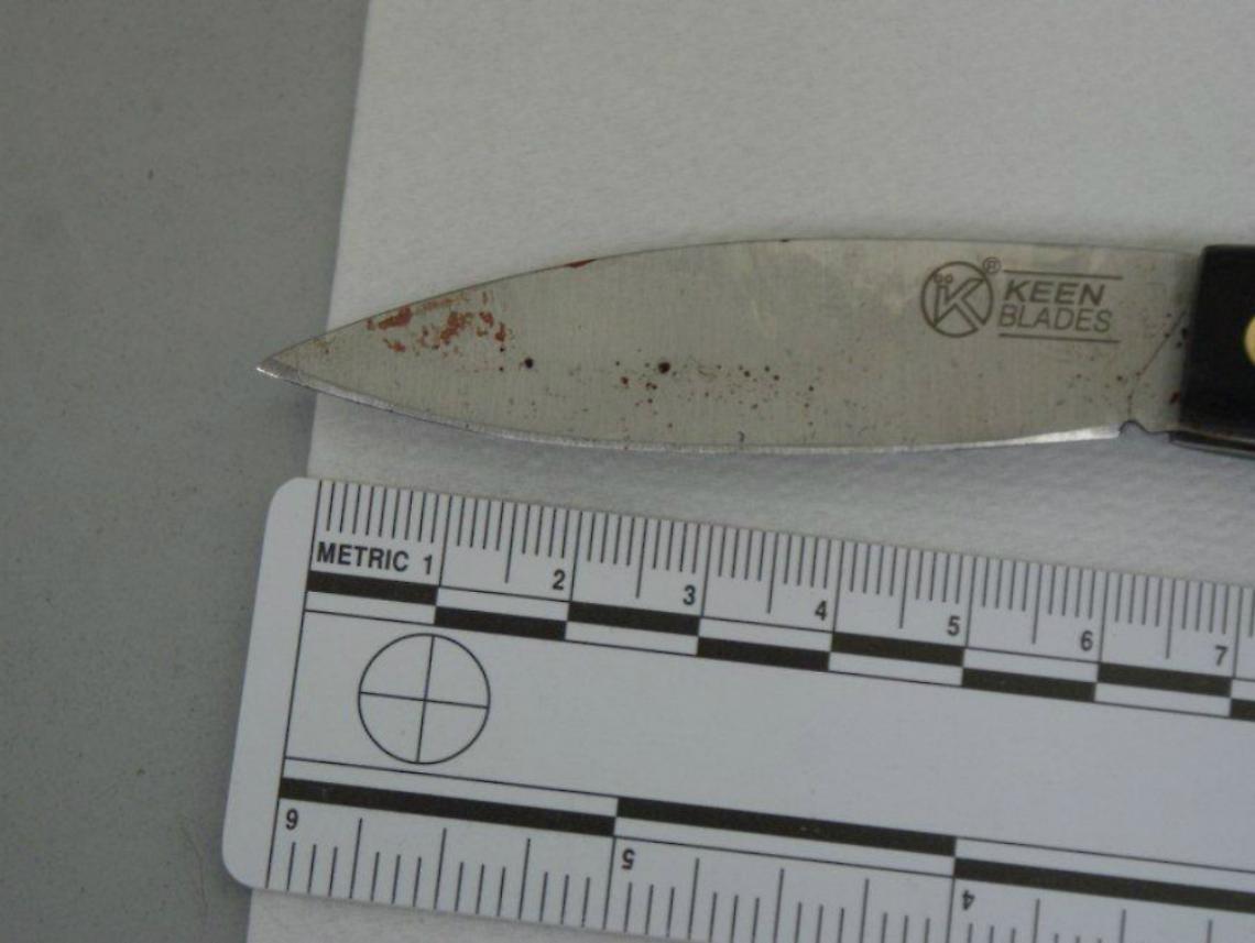 Ancora gravissimo l'albanese accoltellato