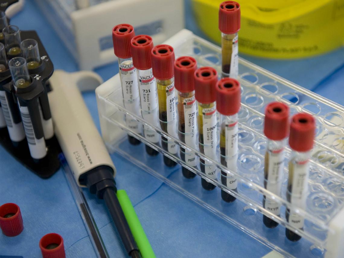 Torna il km0 alla mensa dell'ospedale<br/>Poche certezze sul laboratorio analisi