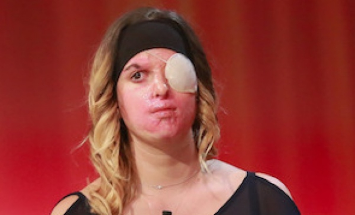 Ad Asti la testimonianza di Gessica Notaro