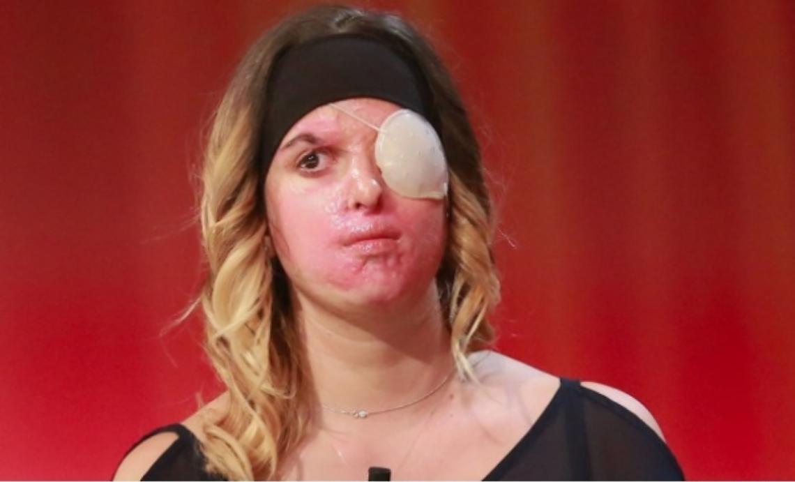 Asti: il video di Gessica per "C'&egrave; chi dice no"