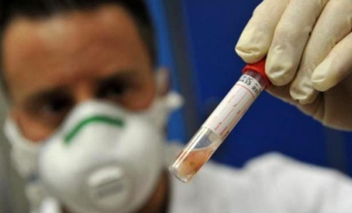 Donna di 50 anni muore di meningite