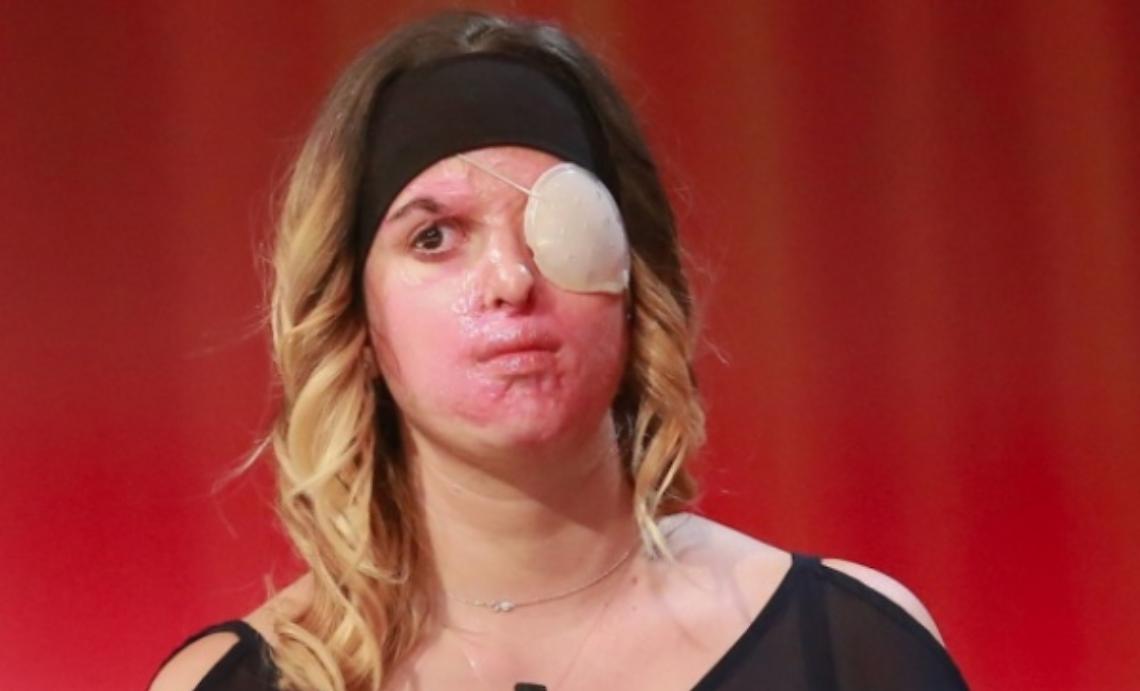 Violenza sulle donne: ad Asti Gessica Notaro