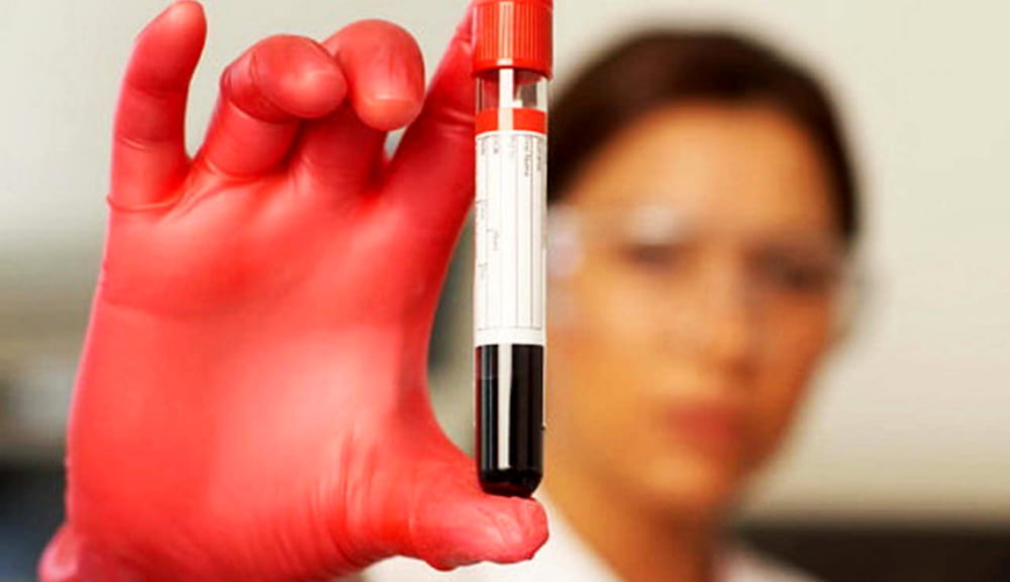 B14B696C-29DC-497D-BF8B-DA6EE162426C