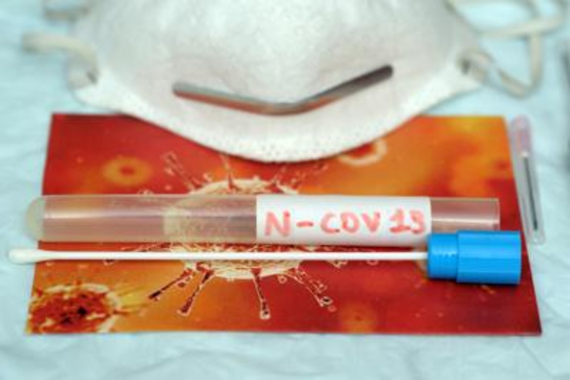 Coronavirus_Tampone_FG