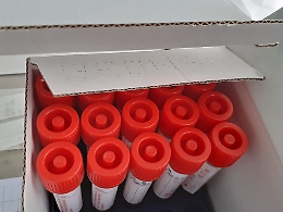 Bollettino: frenata dei contagi, solo 7 in pi&ugrave; da ieri