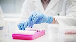 Canelli, il "talento" Saverio Tardito firma importante ricerca sulla coltura di cellule tumorali