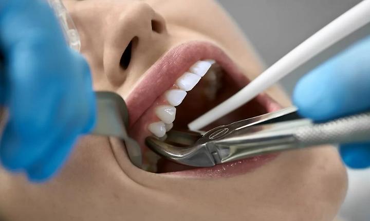 (Ex) dentista condannato per lo scempio sulla bocca di una paziente