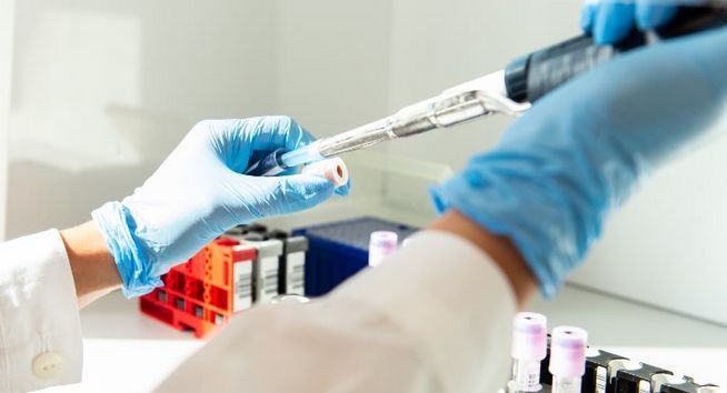Coronavirus, in Piemonte altri tre laboratori per gli esami sui ...