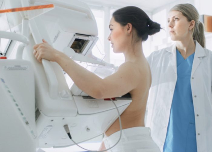 Screening mammografico