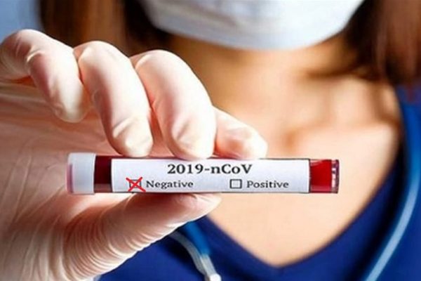 Coronavirus-Negativo-Mistretta-1280x720
