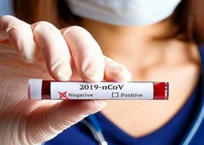 Coronavirus-Negativo-Mistretta-1280x720