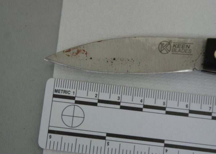 Ancora gravissimo l'albanese accoltellato