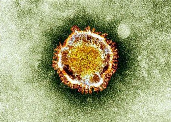 Coranavirus/ Salgono a 30 i decessi, 50 i casi di contagio